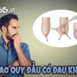 Cắt bao quy đầu có đau không? Câu trả lời chi tiết từ bác sĩ.